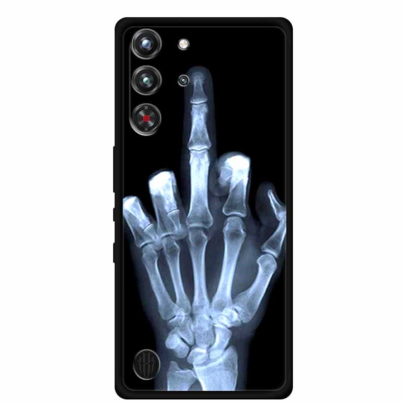 สําหรับ ZTE nubia สีแดง 10 Pro - Redmagic Tablet Accessories บทวิจารณ์และราคา